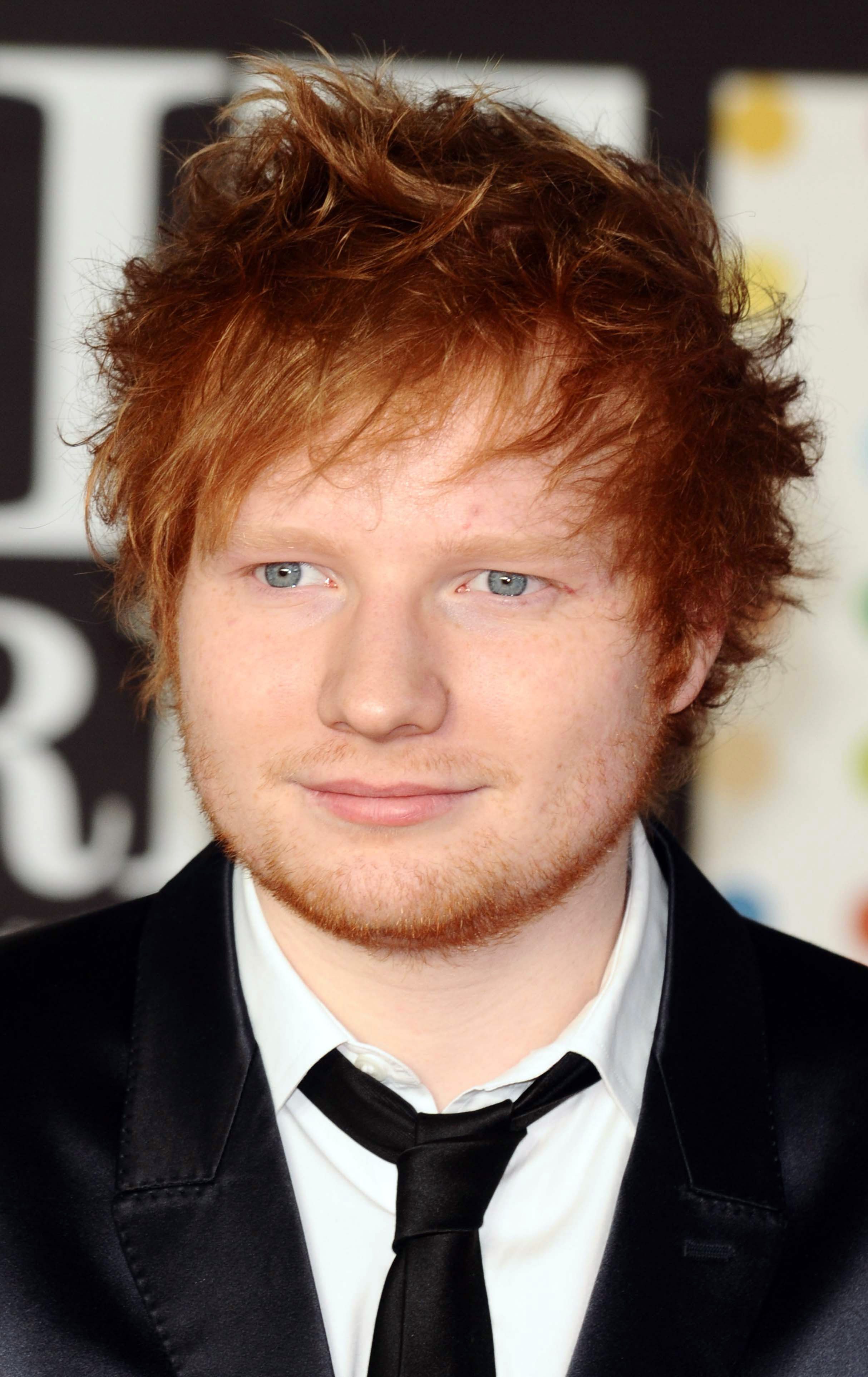 Ed Sheeran's Messy Cowlick 